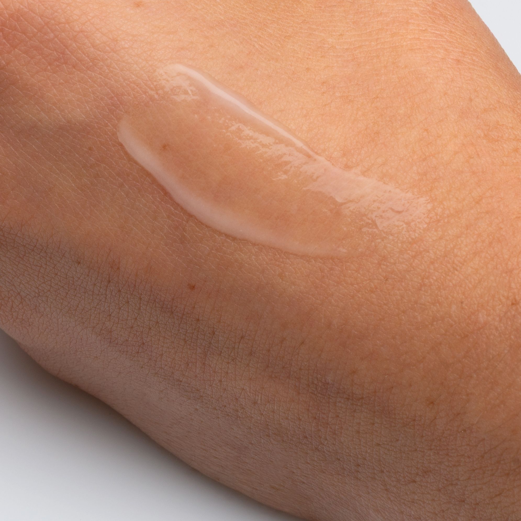 AKNICARE Cream – живильний крем для акне-схильної себорейної шкіри - 2